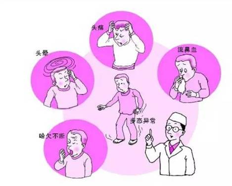 經(jīng)顱多普勒分析儀檢測中風，腦卒中的臨床表現(xiàn)有哪些
